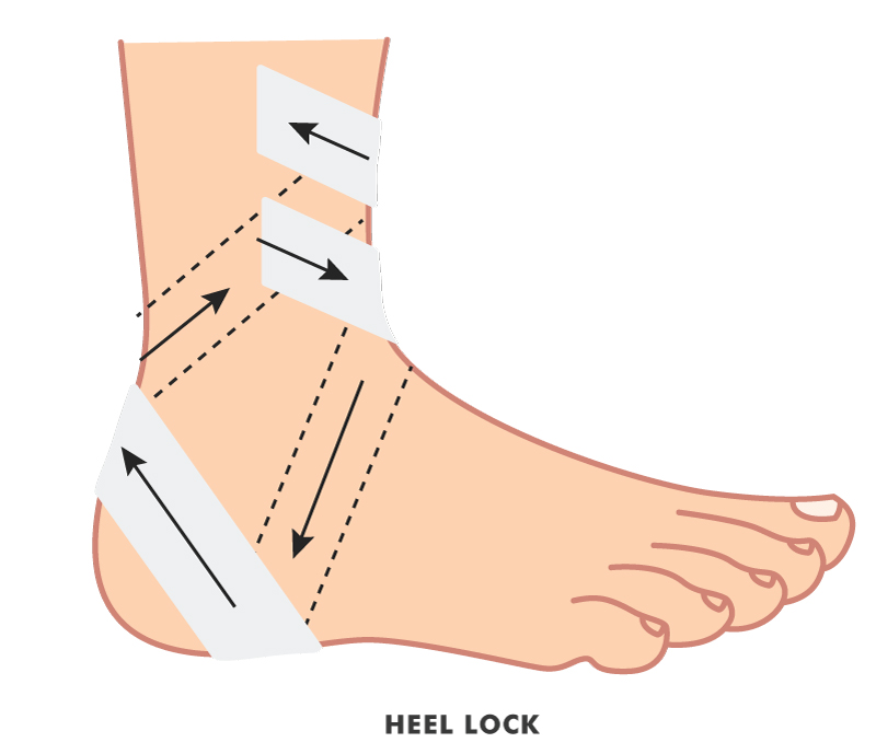 Ankle heel lock
